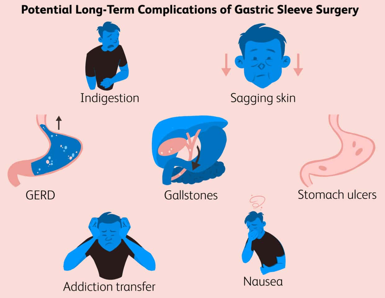 Psychological Impacts After A Gastric Sleeve Surgery All About Gastric Sleeve